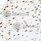 Phosphatase And Tensin Homolog antibody, A2113, ABclonal Technology, Immunohistochemistry paraffin image 