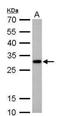 CTD Small Phosphatase 2 antibody, NBP1-32283, Novus Biologicals, Western Blot image 