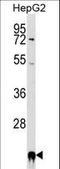 Peptidylprolyl Isomerase F antibody, LS-C163902, Lifespan Biosciences, Western Blot image 