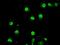Tribbles Pseudokinase 2 antibody, NBP1-48030, Novus Biologicals, Immunofluorescence image 
