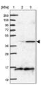 BCS1 Homolog, Ubiquinol-Cytochrome C Reductase Complex Chaperone antibody, PA5-58067, Invitrogen Antibodies, Western Blot image 