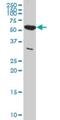 Pyruvate Kinase M1/2 antibody, H00005315-M01A, Novus Biologicals, Western Blot image 