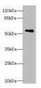 Zinc Finger And SCAN Domain Containing 32 antibody, A62018-100, Epigentek, Western Blot image 