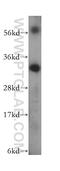 TNFRSF1A Associated Via Death Domain antibody, 15468-1-AP, Proteintech Group, Western Blot image 