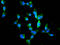 Mex-3 RNA Binding Family Member B antibody, LS-C680854, Lifespan Biosciences, Immunofluorescence image 