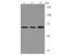 Ectonucleoside Triphosphate Diphosphohydrolase 1 antibody, NBP2-67230, Novus Biologicals, Western Blot image 