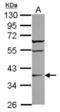 ST6 N-Acetylgalactosaminide Alpha-2,6-Sialyltransferase 2 antibody, NBP2-20494, Novus Biologicals, Western Blot image 