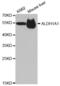 Aldehyde Dehydrogenase 1 Family Member A1 antibody, abx001492, Abbexa, Western Blot image 