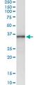 Msh Homeobox 1 antibody, MA5-19366, Invitrogen Antibodies, Immunoprecipitation image 