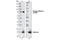 ALK Receptor Tyrosine Kinase antibody, 3343S, Cell Signaling Technology, Western Blot image 