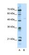 Transcription Factor EB antibody, orb330020, Biorbyt, Western Blot image 