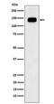 General Transcription Factor IIi antibody, M00903, Boster Biological Technology, Western Blot image 