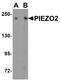 Piezo Type Mechanosensitive Ion Channel Component 1 antibody, A01721, Boster Biological Technology, Western Blot image 