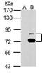 Tetratricopeptide Repeat Domain 39B antibody, PA5-32227, Invitrogen Antibodies, Western Blot image 