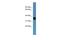 Aldo-keto reductase family 1 member C1 antibody, A03056, Boster Biological Technology, Western Blot image 