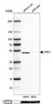 VRK Serine/Threonine Kinase 1 antibody, NBP1-85822, Novus Biologicals, Western Blot image 