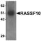 Ras Association Domain Family Member 10 antibody, orb178847, Biorbyt, Western Blot image 