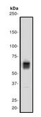 Lamin B Receptor antibody, ab32535, Abcam, Western Blot image 