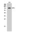 S28A2 antibody, A07211-2, Boster Biological Technology, Western Blot image 