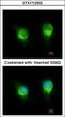 Kinectin 1 antibody, GTX112532, GeneTex, Immunocytochemistry image 