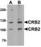 Crumbs Cell Polarity Complex Component 2 antibody, A05652, Boster Biological Technology, Western Blot image 