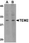 RASD Family Member 2 antibody, TA319863, Origene, Western Blot image 