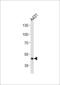 Fibrinogen Gamma Chain antibody, 62-824, ProSci, Western Blot image 