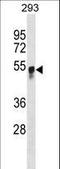 Glucosaminyl (N-Acetyl) Transferase 3, Mucin Type antibody, LS-C166417, Lifespan Biosciences, Western Blot image 