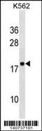 Ribosomal Protein Lateral Stalk Subunit P2 antibody, 63-899, ProSci, Western Blot image 