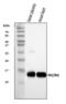 Hemoglobin Subunit Alpha 2 antibody, A00233-2, Boster Biological Technology, Western Blot image 