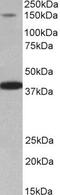 Insulin Receptor Substrate 4 antibody, PA5-37926, Invitrogen Antibodies, Western Blot image 