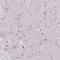 Nucleolar Protein Interacting With The FHA Domain Of MKI67 antibody, NBP2-48643, Novus Biologicals, Immunohistochemistry frozen image 