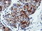 Adenylate Kinase 5 antibody, LS-C115582, Lifespan Biosciences, Immunohistochemistry frozen image 