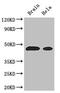 Argininosuccinate Synthase 1 antibody, CSB-PA002234LA01HU, Cusabio, Western Blot image 