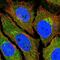 Adenosine Deaminase TRNA Specific 2 antibody, PA5-57287, Invitrogen Antibodies, Immunofluorescence image 
