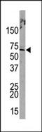 Promyelocytic Leukemia antibody, MBS9210961, MyBioSource, Western Blot image 