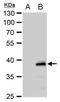 Chitinase 3 Like 2 antibody, PA5-21548, Invitrogen Antibodies, Western Blot image 