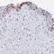 Serine And Arginine Rich Splicing Factor 3 antibody, NBP2-38815, Novus Biologicals, Immunohistochemistry paraffin image 
