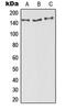 Ro antibody, MBS821425, MyBioSource, Western Blot image 