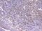 Integrin Subunit Beta 2 antibody, M00458-1, Boster Biological Technology, Immunohistochemistry frozen image 