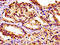 Calcium/Calmodulin Dependent Protein Kinase Kinase 2 antibody, LS-C672265, Lifespan Biosciences, Immunohistochemistry paraffin image 