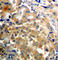 Protein Kinase C Zeta antibody, abx000480, Abbexa, Western Blot image 