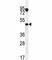 Vascular Endothelial Growth Factor C antibody, F41806-0.4ML, NSJ Bioreagents, Western Blot image 