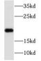 N(Alpha)-Acetyltransferase 20, NatB Catalytic Subunit antibody, FNab05564, FineTest, Western Blot image 