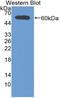 Iodothyronine Deiodinase 2 antibody, LS-C314935, Lifespan Biosciences, Western Blot image 