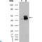 Fyn Related Src Family Tyrosine Kinase antibody, LS-C814075, Lifespan Biosciences, Western Blot image 