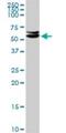 CUGBP Elav-Like Family Member 2 antibody, H00010659-D01P, Novus Biologicals, Western Blot image 