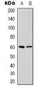 Nuclear Receptor Binding Protein 1 antibody, abx133589, Abbexa, Western Blot image 