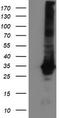 Glutathione S-Transferase Theta 2 (Gene/Pseudogene) antibody, LS-C172410, Lifespan Biosciences, Western Blot image 