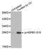 Heat Shock Protein Family B (Small) Member 1 antibody, STJ22180, St John